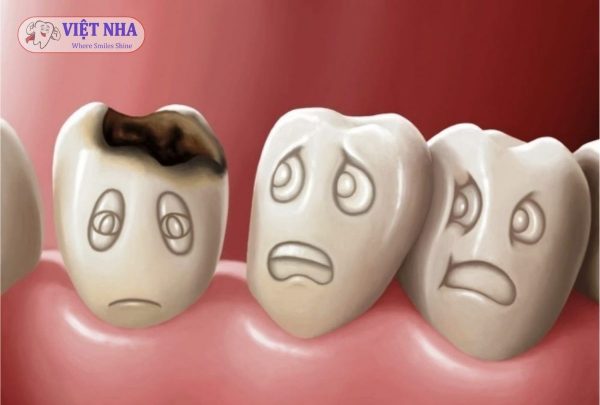 Các bệnh lý răng miệng phổ biến