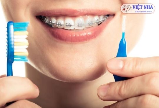 Răng có yếu đi sau khi niềng răng không?