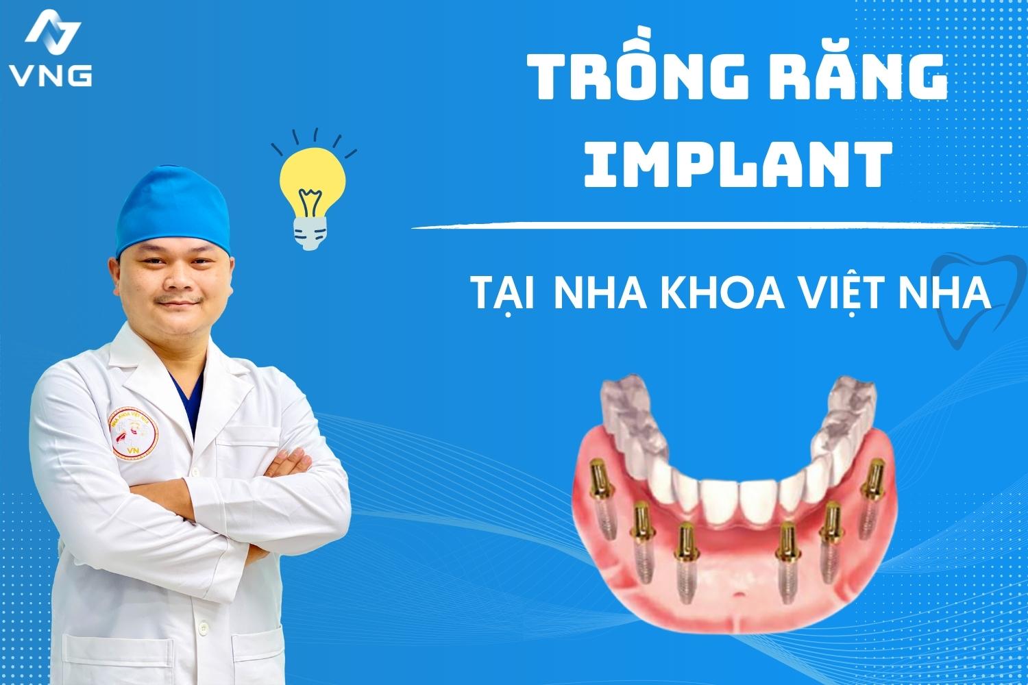 Cấy ghép Implant All On 6 phương pháp phục hình răng hiệu quả