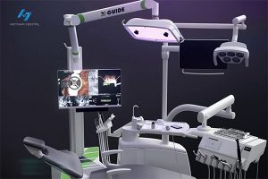 Công Nghệ Cấy Ghép Implant Bằng Robot Định Vị X-Guide