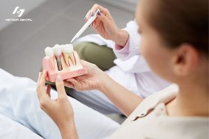 Những ưu điểm nổi bật của răng Implant