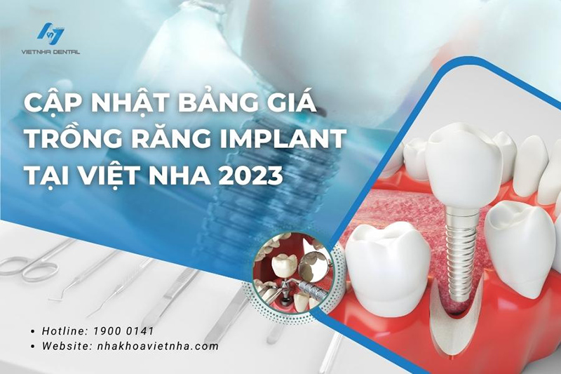 Cập Nhật Bảng Giá Trồng Răng Implant Tại Việt Nha 2023