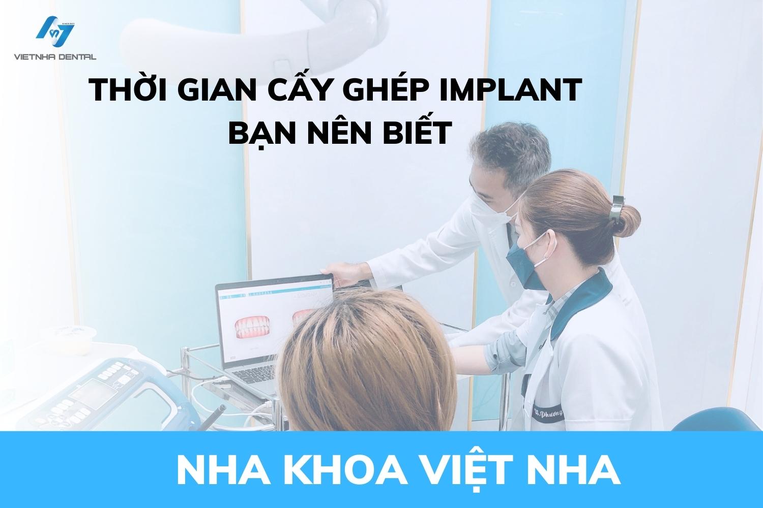 Thời Gian Cấy Ghép Implant Mất Khoảng Bao Lâu? Nha Khoa Việt Nha